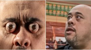 The most epic "eye-punch" to date (5 photos + 1 video)