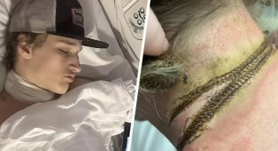 A teenager fell asleep with a chain around his neck next to a charger and received an electric shock (4 photos)