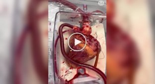 How the heart works