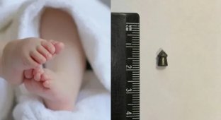 A baby with a bullet in his stomach was born in the Moscow region (5 photos)