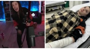 Девушка получила травму во время прямой трансляции (2 фото + 1 видео)