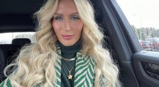 Dental implants made me a monster: the model spoke about her terrible experience (4 photos + 1 video)