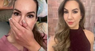 Женщина не могла носить обувь несколько месяцев после неудачного удаления татуировки (4 фото)
