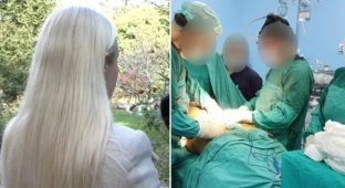 Breast Augmentation: Fake Doctor Performs Plastic Surgeries on Women in Turkey (4 photos)