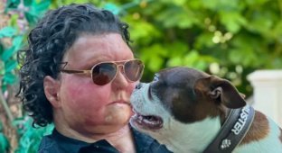 A man after a face transplant showed whether his own dogs recognized him (3 photos + 1 video)