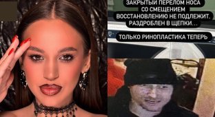 In Russia, a man who was not allowed into a bar broke a girl’s nose out of resentment and ran away (2 photos + 2 videos)