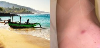 “Burn it”: a family who picked up a strange infection while on vacation in Bali was asked not to return to the Russian Federation (2 photos + 1 video)