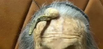 The secret of longevity: a woman from China 107 years old with a "devil's horn" on his forehead (4 photos)