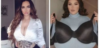 A woman spoke about her struggle with size 18 breasts, which do not stop growing due to a rare disease (5 photos)