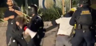 A 21-year-old protester was blinded in one eye after being shot in the face (2 photos + 1 video)