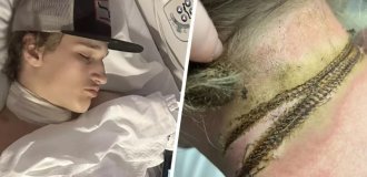 A teenager fell asleep with a chain around his neck next to a charger and received an electric shock (4 photos)