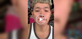 A guy sealed his mouth with glue