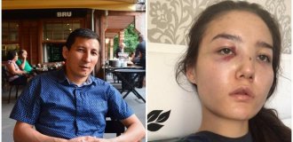 The wife of a Kazakh diplomat said that he beat and raped her for 10 years (3 photos + 1 video)