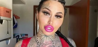 A 33-year-old plastic surgery victim, called a "living blow-up doll," died in Thailand (9 photos)