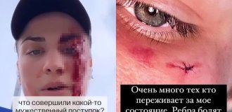 "Вы думаете,  что совершили мужественный поступок?": в Швейцарии чеченцы  избили спортсменку-соотечественницу из-за её спортивной одежды  и "неженского" поведения (2 фото + 1 видео)