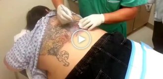 Complications after tattooing