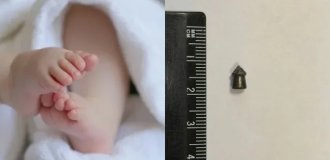 A baby with a bullet in his stomach was born in the Moscow region (5 photos)