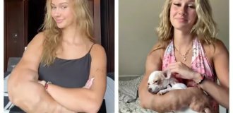 A vascular defect became the reason for the giant growth of the hand (2 photos + 2 videos)