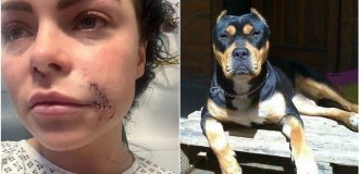 A dog attacked a woman and mutilated her face (8 photos)