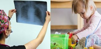 In Tyva, a teacher infected 9 children with tuberculosis (2 photos)