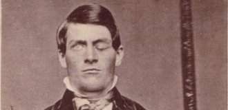 Scientists show Phineas Gage's face moments after the accident (7 photos + 1 video)