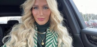 Dental implants made me a monster: the model spoke about her terrible experience (4 photos + 1 video)