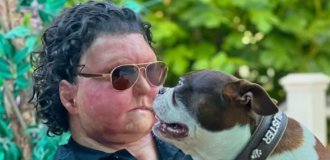 A man after a face transplant showed whether his own dogs recognized him (3 photos + 1 video)