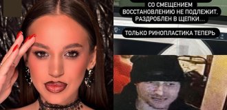 In Russia, a man who was not allowed into a bar broke a girl’s nose out of resentment and ran away (2 photos + 2 videos)