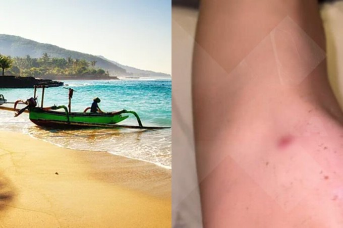 “Burn it”: a family who picked up a strange infection while on vacation in Bali was asked not to return to the Russian Federation (2 photos + 1 video)