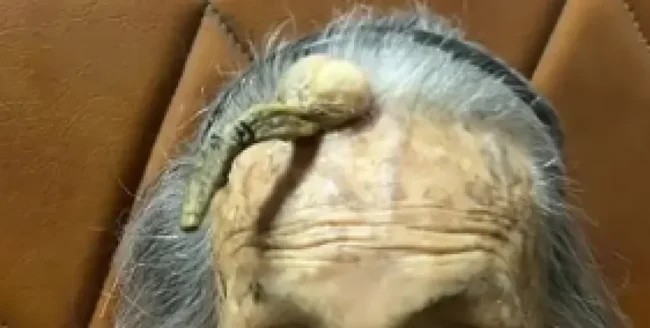 The secret of longevity: a woman from China 107 years old with a "devil's horn" on his forehead (4 photos)