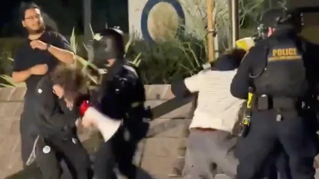 21‑летний участник протеста ослеп на один глаз после выстрела в лицо (2 фото)