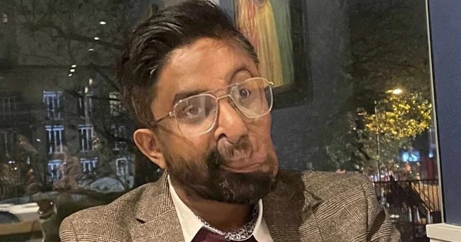Man with Facial Tumor Refused Service in London Cafe (5 photos)