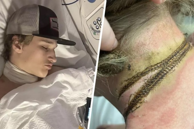 A teenager fell asleep with a chain around his neck next to a charger and received an electric shock (4 photos)