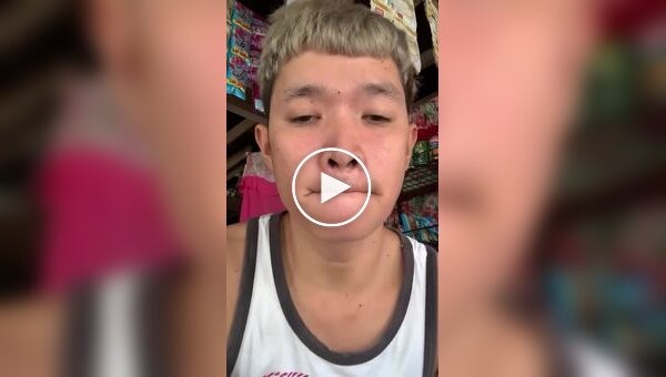 Парень заклеил себе рот клеем