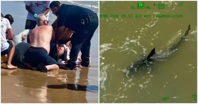 Sharks attacked people near the beach in Texas and Florida (3 photos + 2 videos)