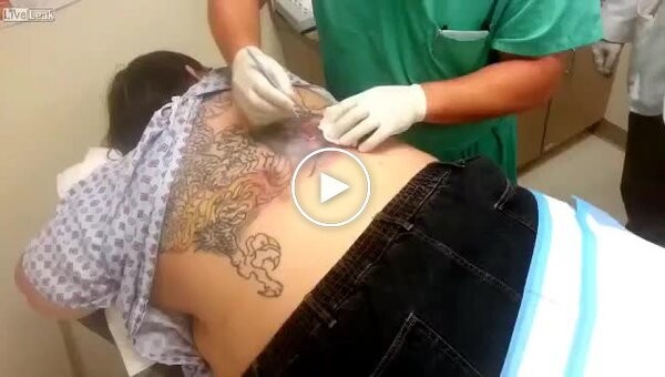 Complications after tattooing