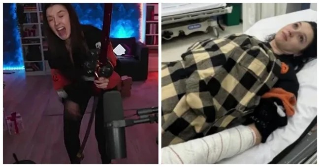 Девушка получила травму во время прямой трансляции (2 фото + 1 видео)