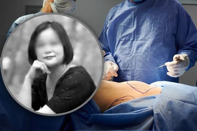 In China, a woman died after six plastic surgeries in 24 hours (3 photos)