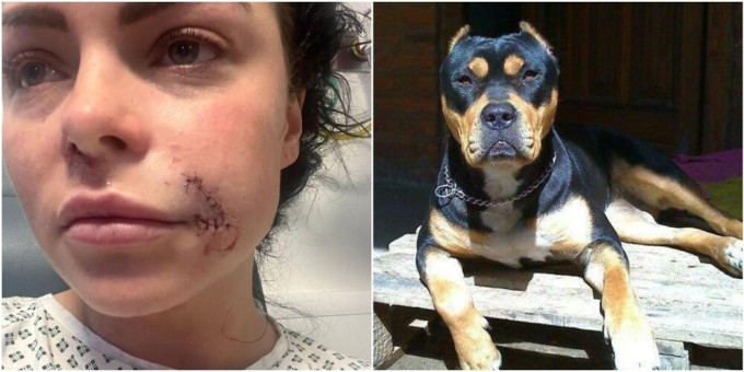 A dog attacked a woman and mutilated her face (8 photos)