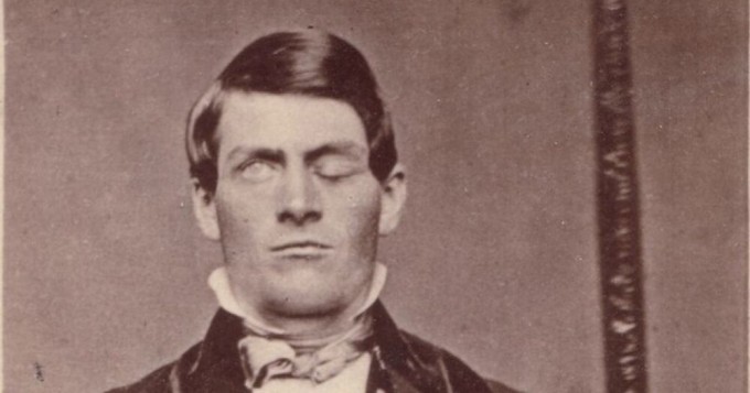 Scientists show Phineas Gage's face moments after the accident (7 photos + 1 video)