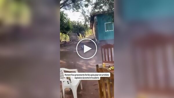 Мужчина лишился ступни, наступив ногой на петарду