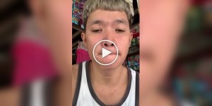 Парень заклеил себе рот клеем