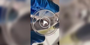 Not just a seasoning: chili against parasites